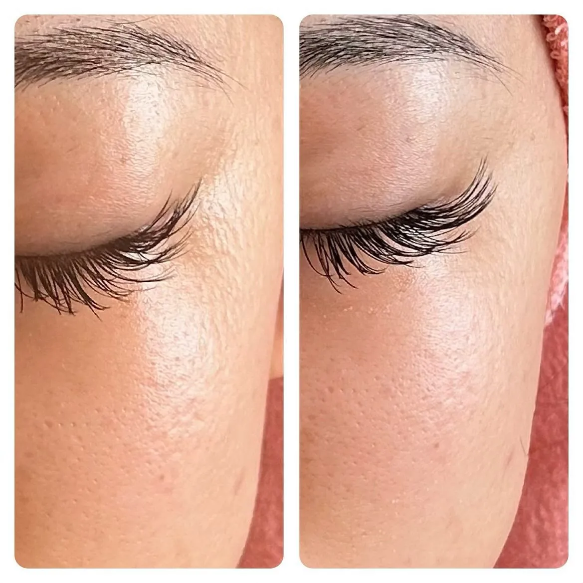 ハーバルピーリン体験